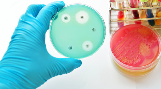 Programme national de recherche "La résistance aux antimicrobiens" (PNR 72)